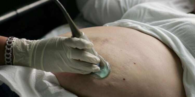 Here’s why people are paying more to get pregnancy care than ever before