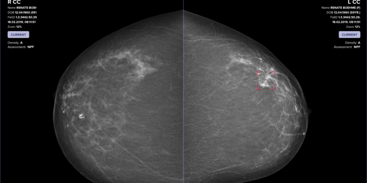 How AI brings accessibility and equity to healthcare