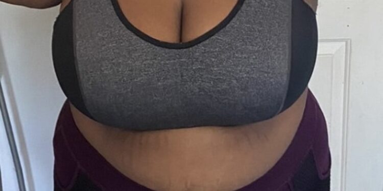 Weight Loss With Wegovy or Ozempic: Insurance Frustrates Patients